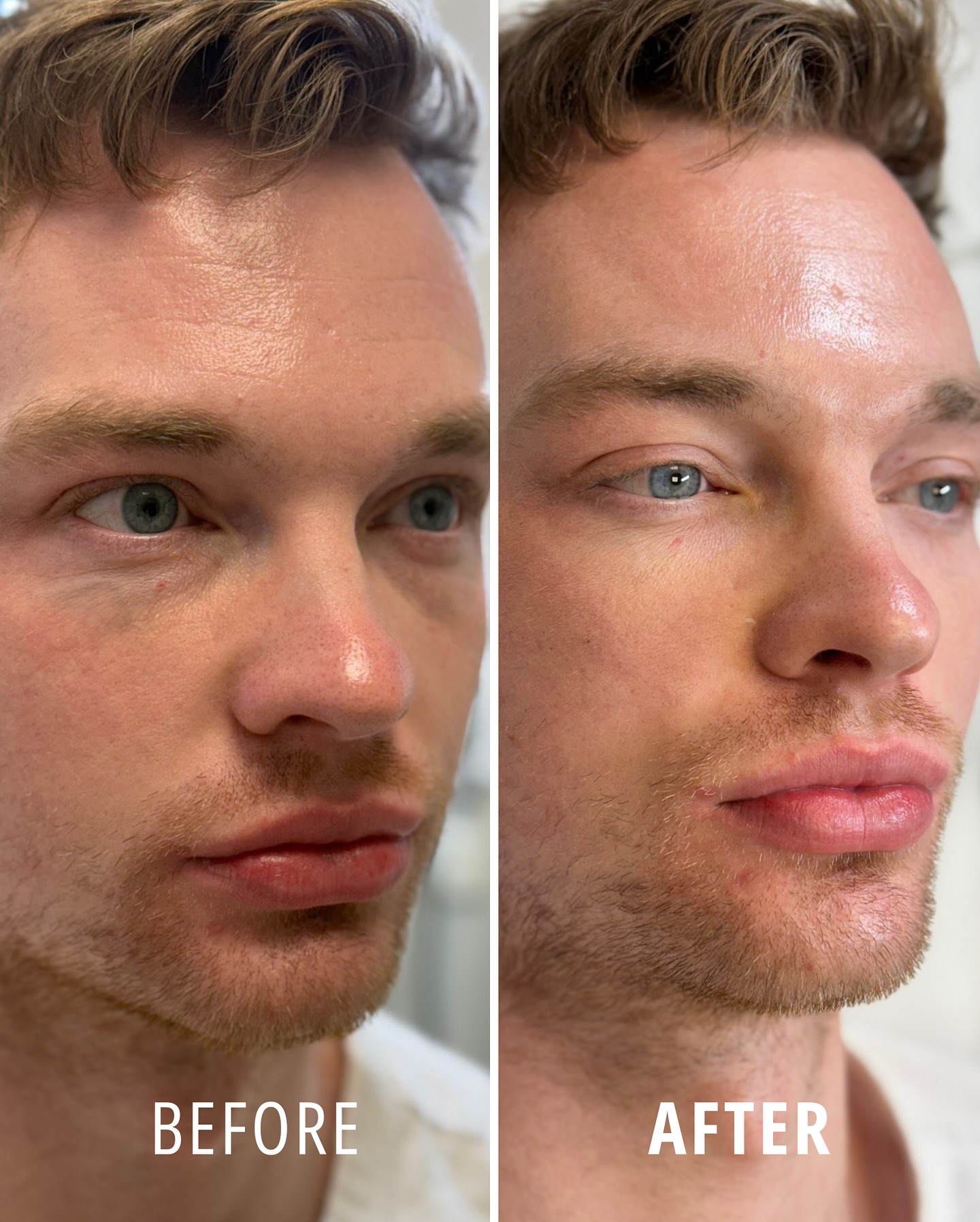 Vita Cosmetic and Laser Clinic Facebook ad: Considering an under-eye rejuvenation procedure?
