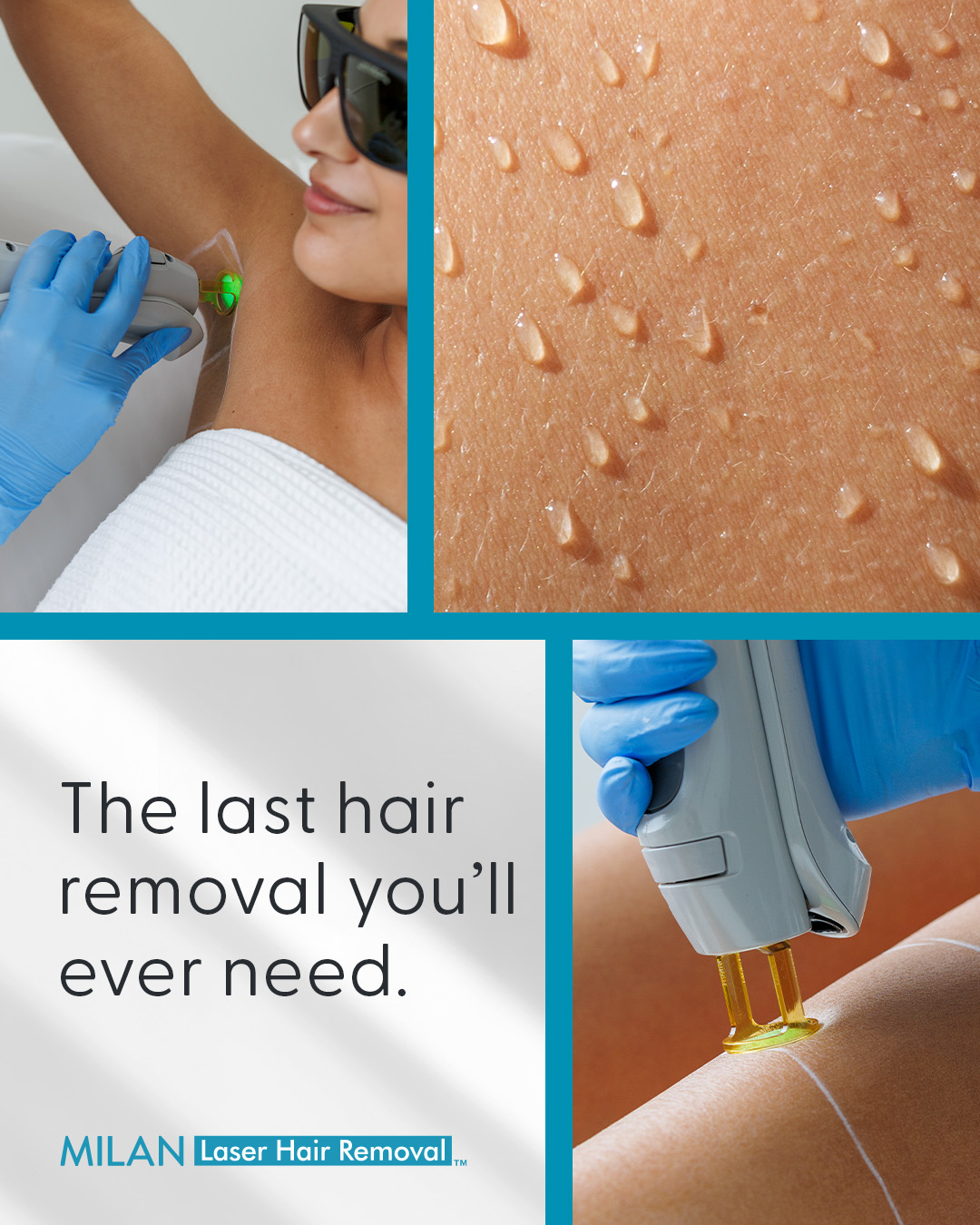 Milan Laser Hair Removal Facebook ad