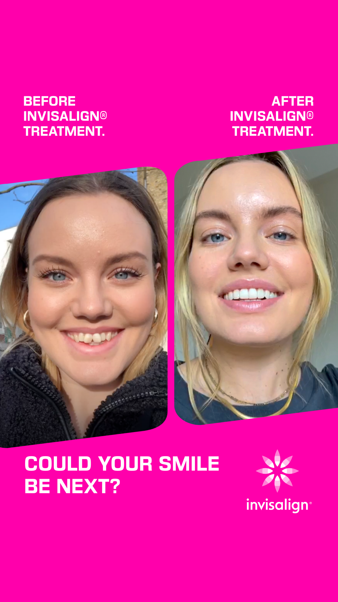 Invisalign UK & Ireland Facebook ad