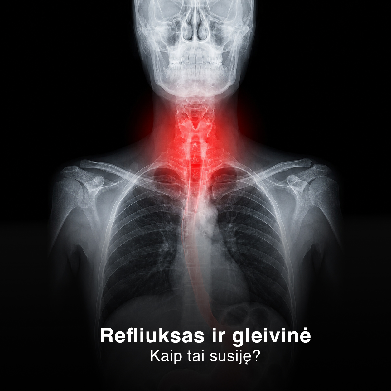 Skrandžio ABC Facebook ad: Refliuksas ir gleivinės dirginimas