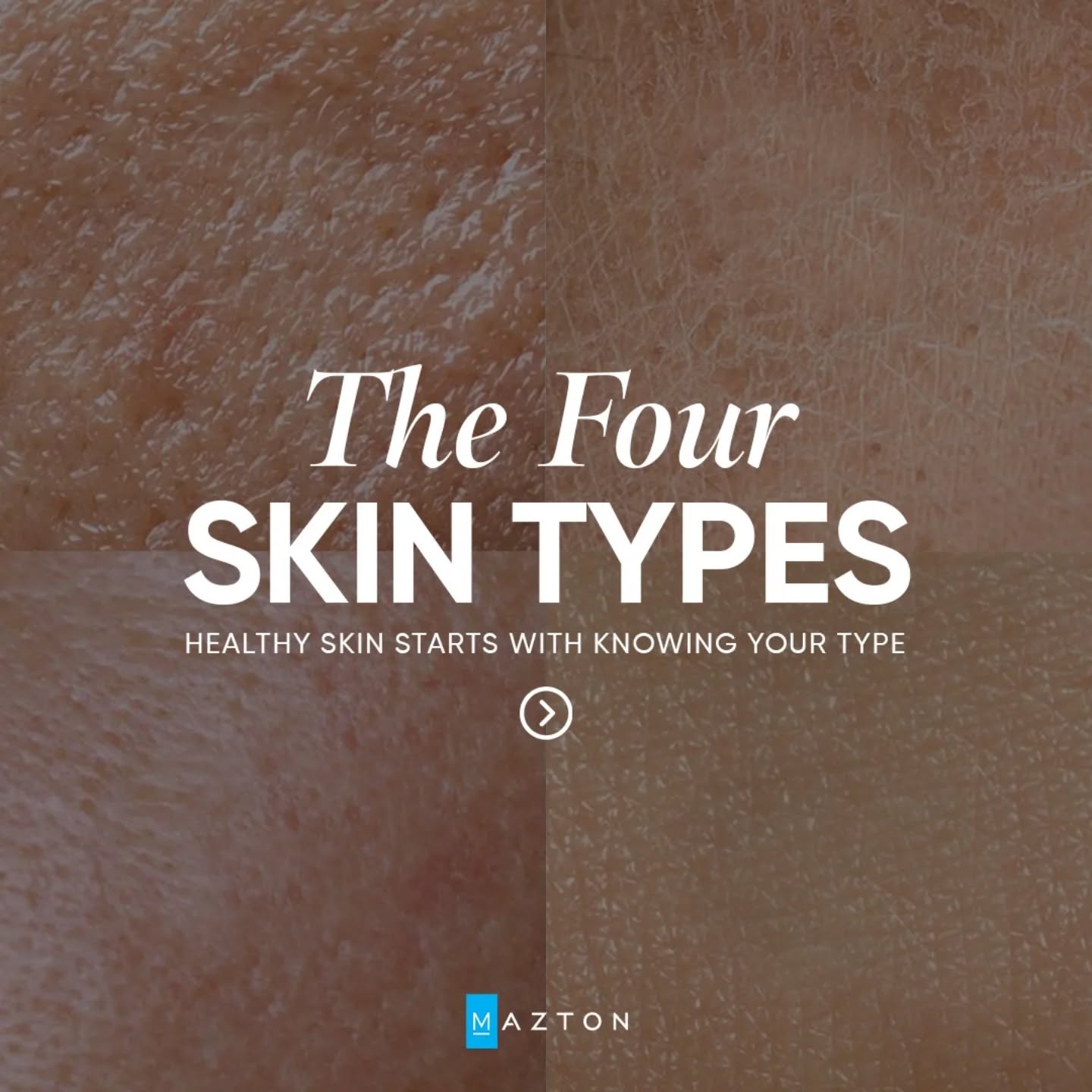 Mazton Skin Solutions Facebook ad