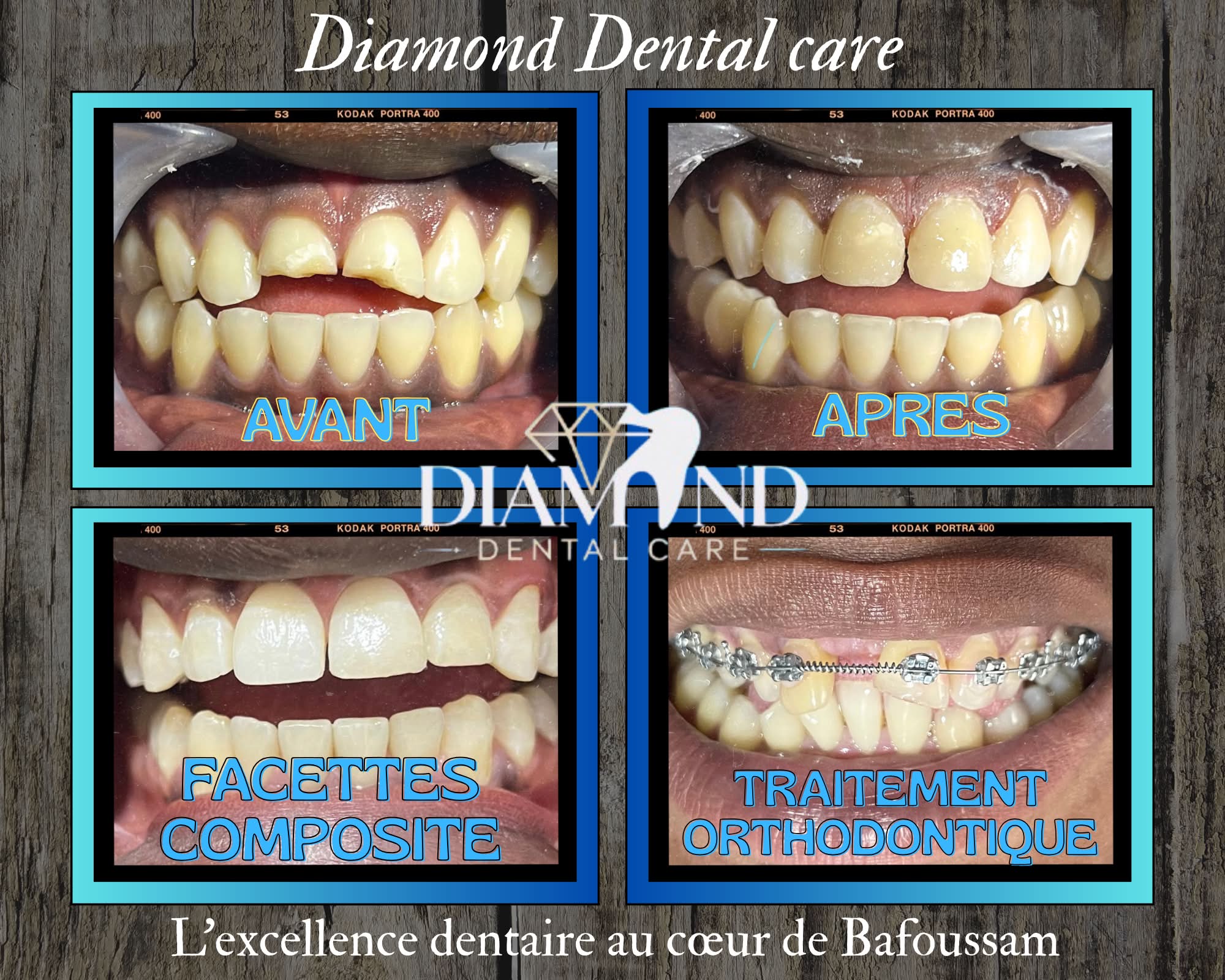 Diamond Dental care Facebook ad: Chaque sourire mérite une seconde chance.