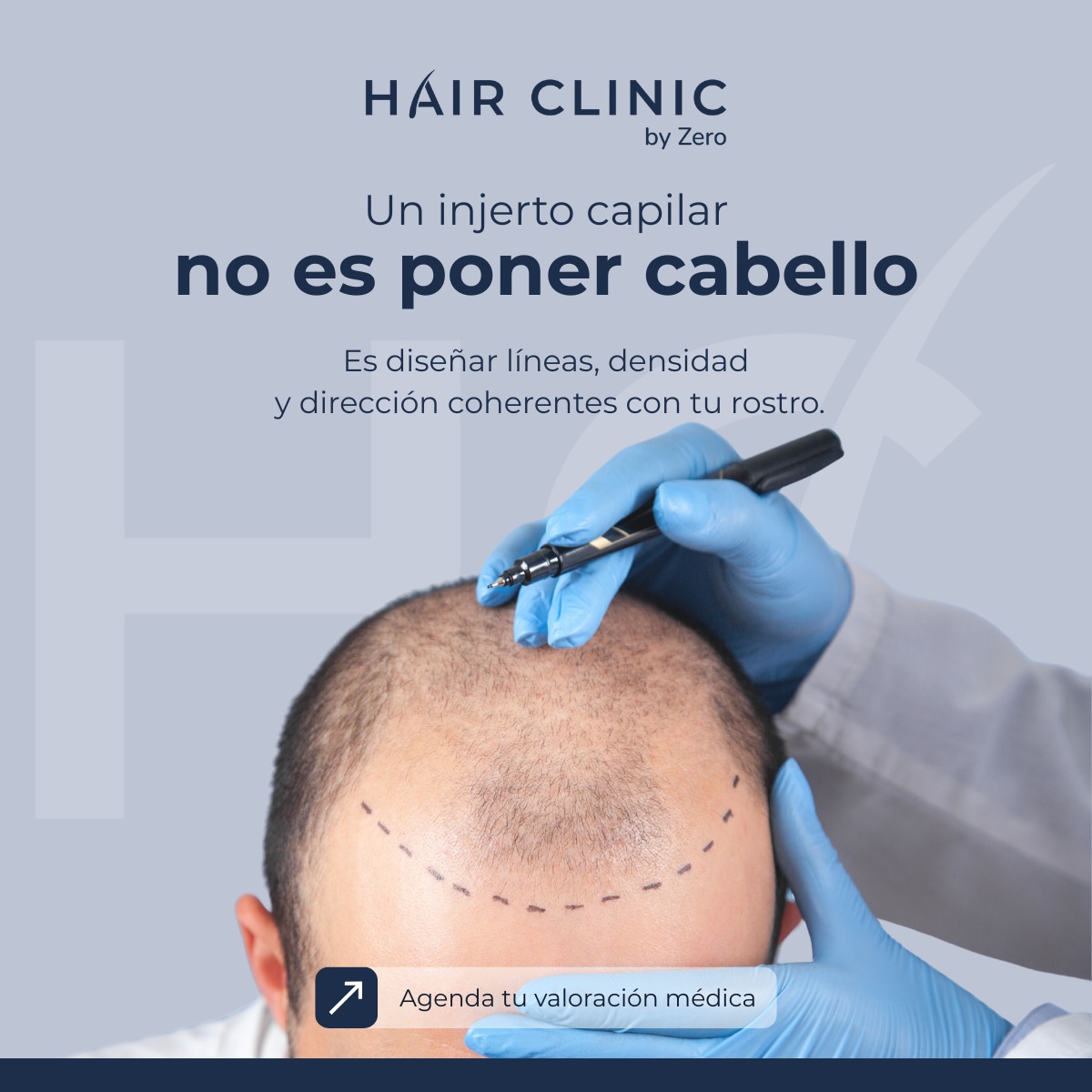 Hair Clinic By Zero Facebook ad: ¡Agenda una cita de valoración!