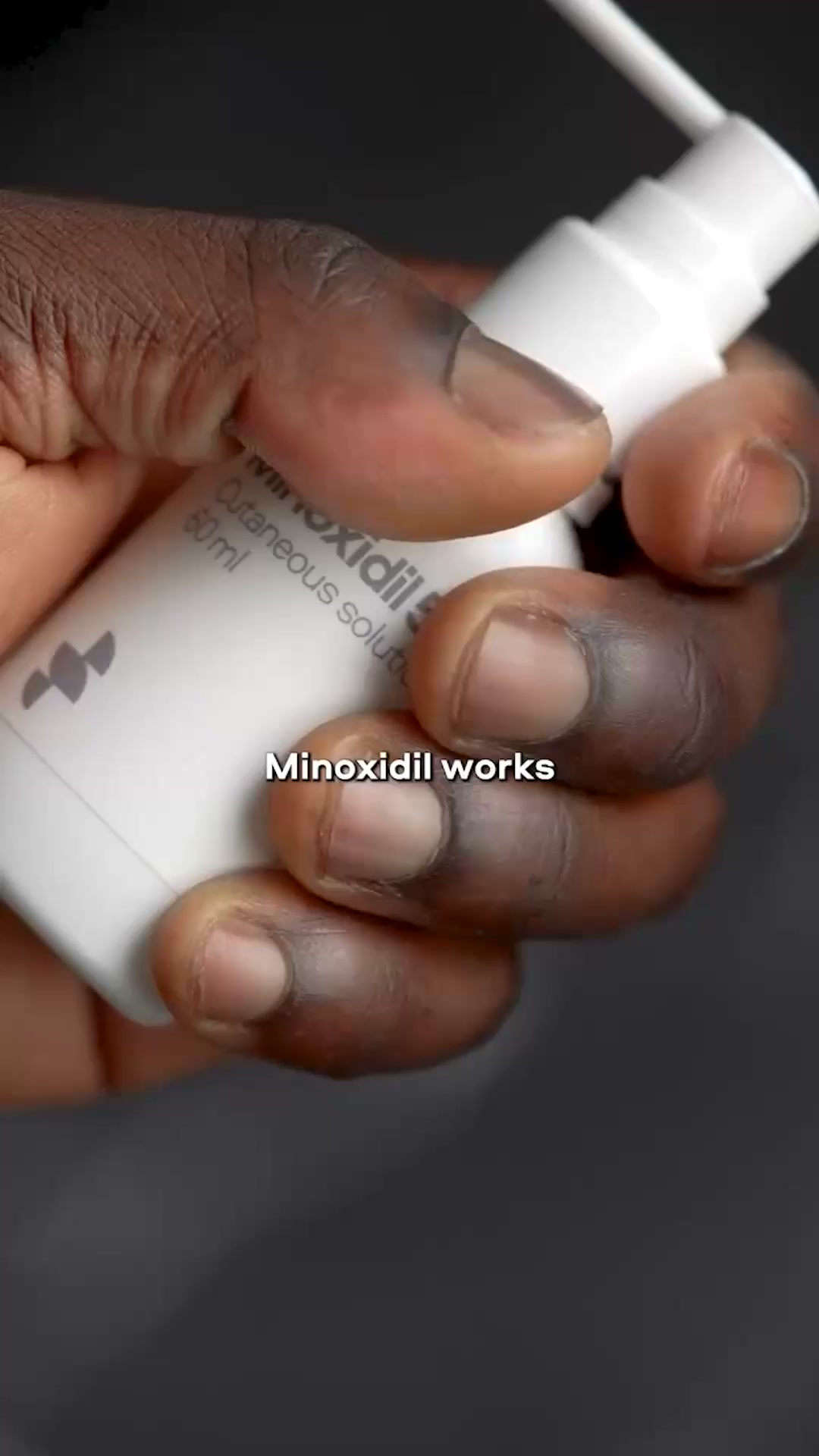 Sons Facebook ad: Your hairline. Your call.