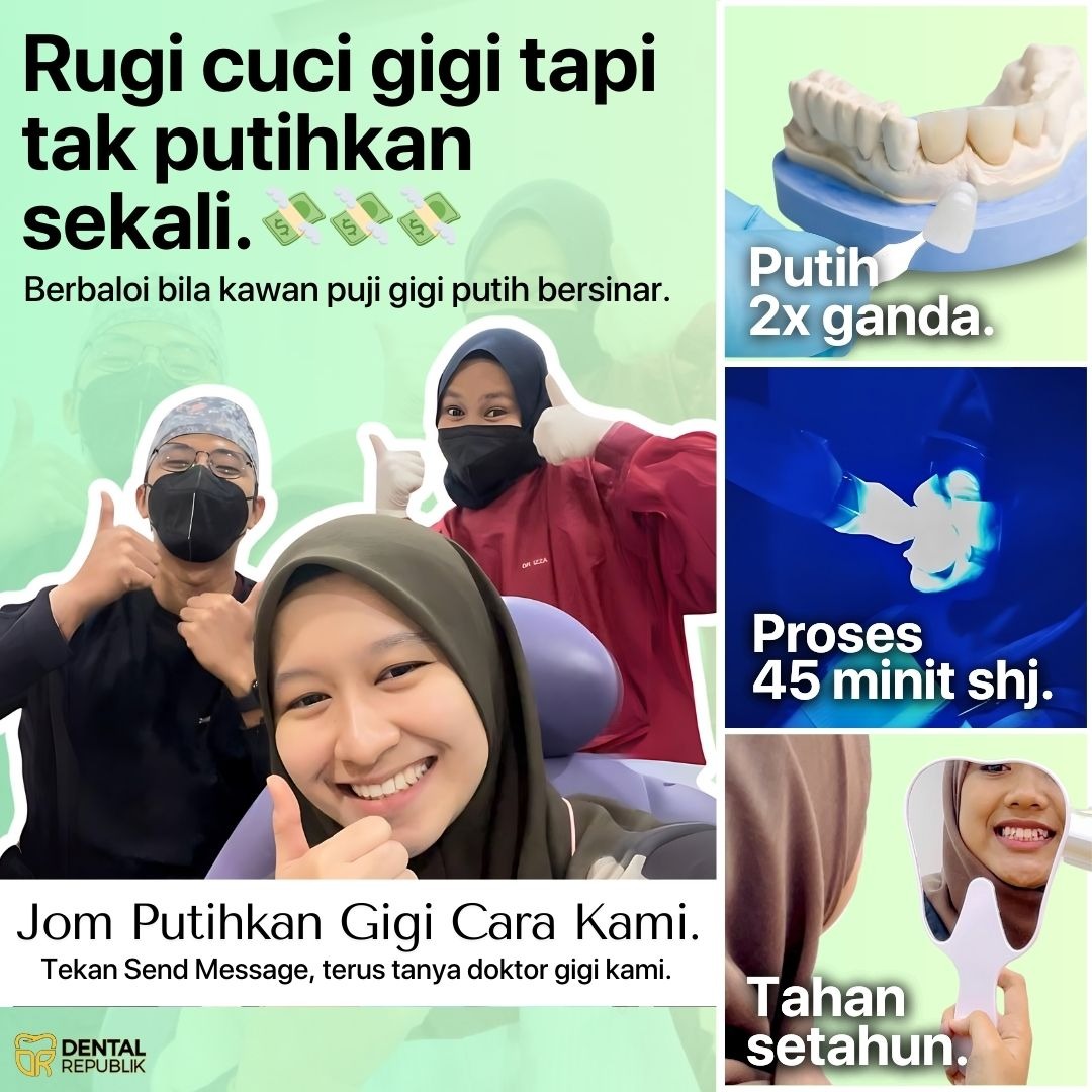 Klinik Gigi Darulaman Jitra Facebook ad: Putih gigi secepat 45 minit