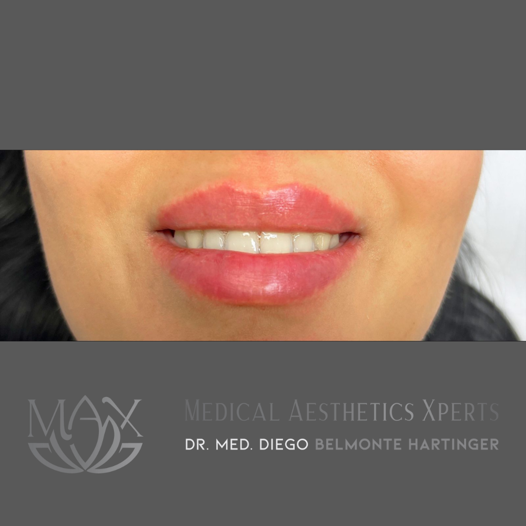Medical Aesthetics Xperts - MAX Facebook ad