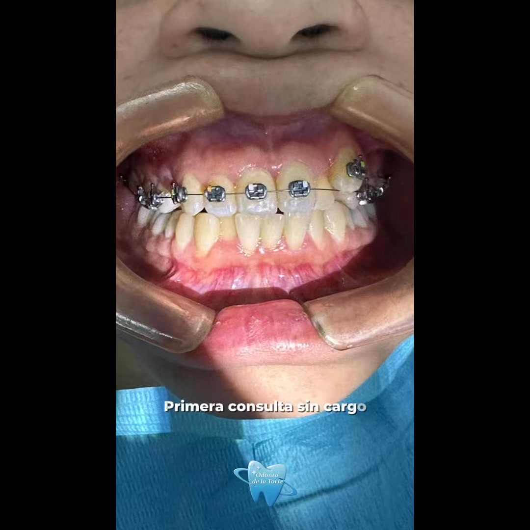 Odontología Delatorre Facebook ad from Jun 8, 2026