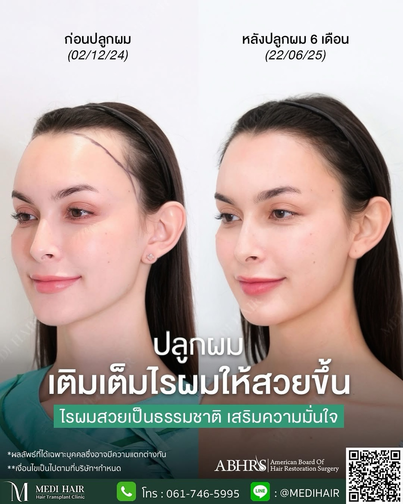 MEDI HAIR Facebook ad