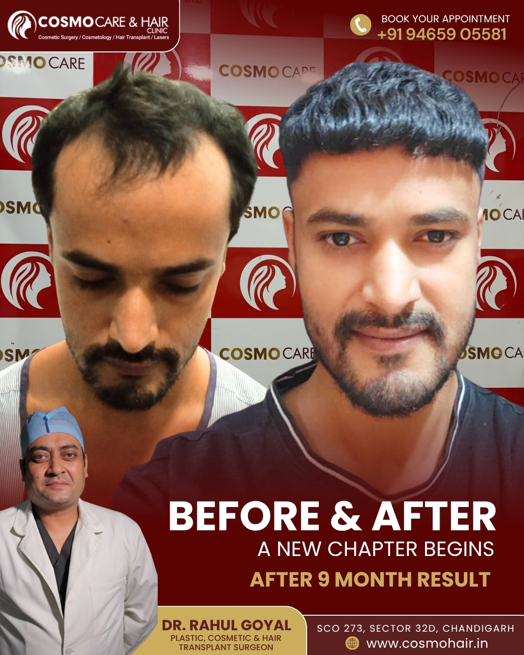 Cosmo Care & Hair Clinic - Chandigarh Facebook ad: Chat with us