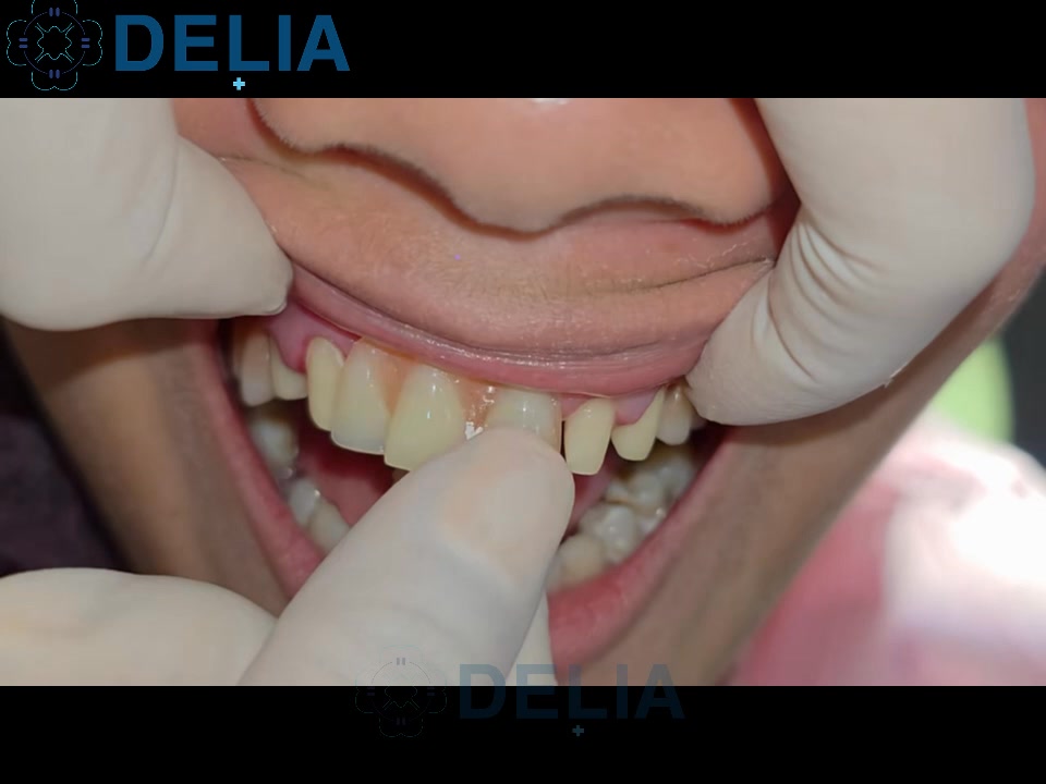 Delia Dental Clinic Facebook ad: FREE consultation today