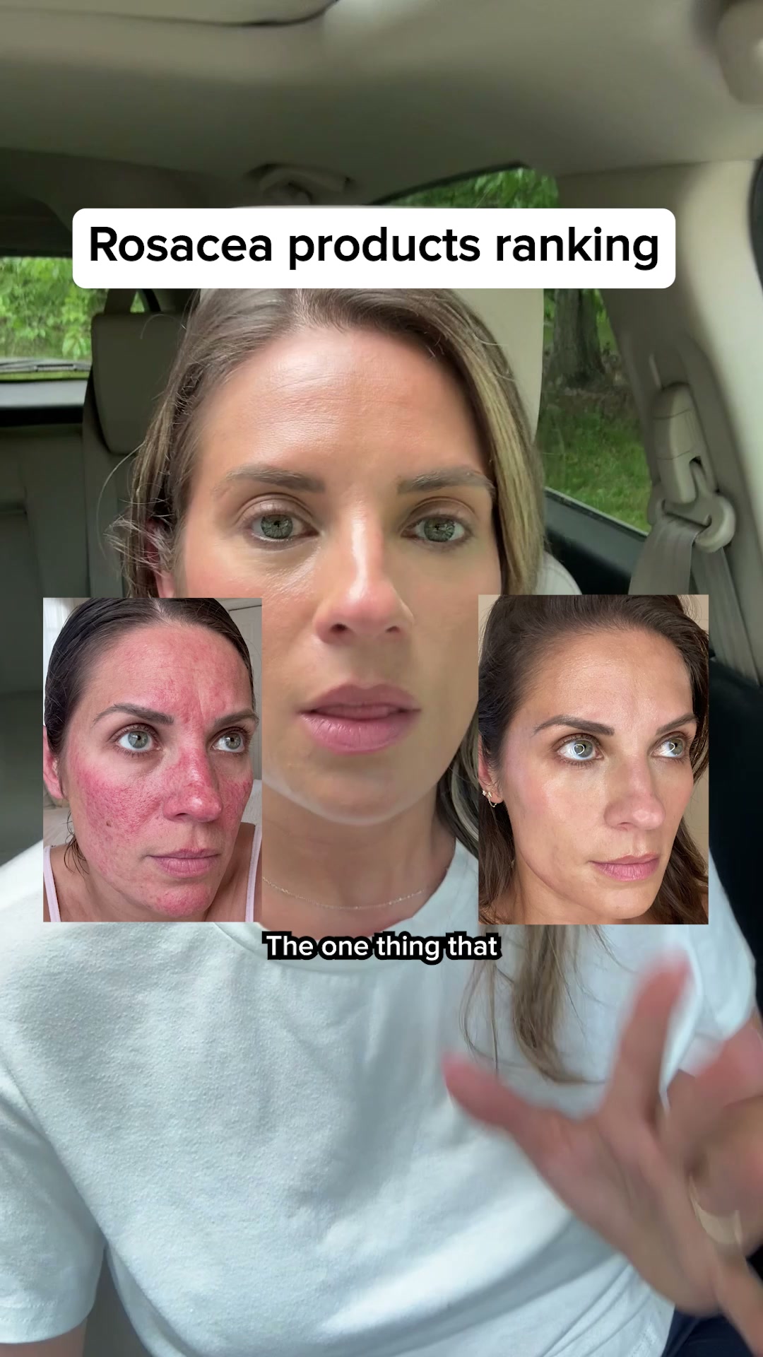 Based Supplies Facebook ad: Restore Your Skin in 3 Weeks!