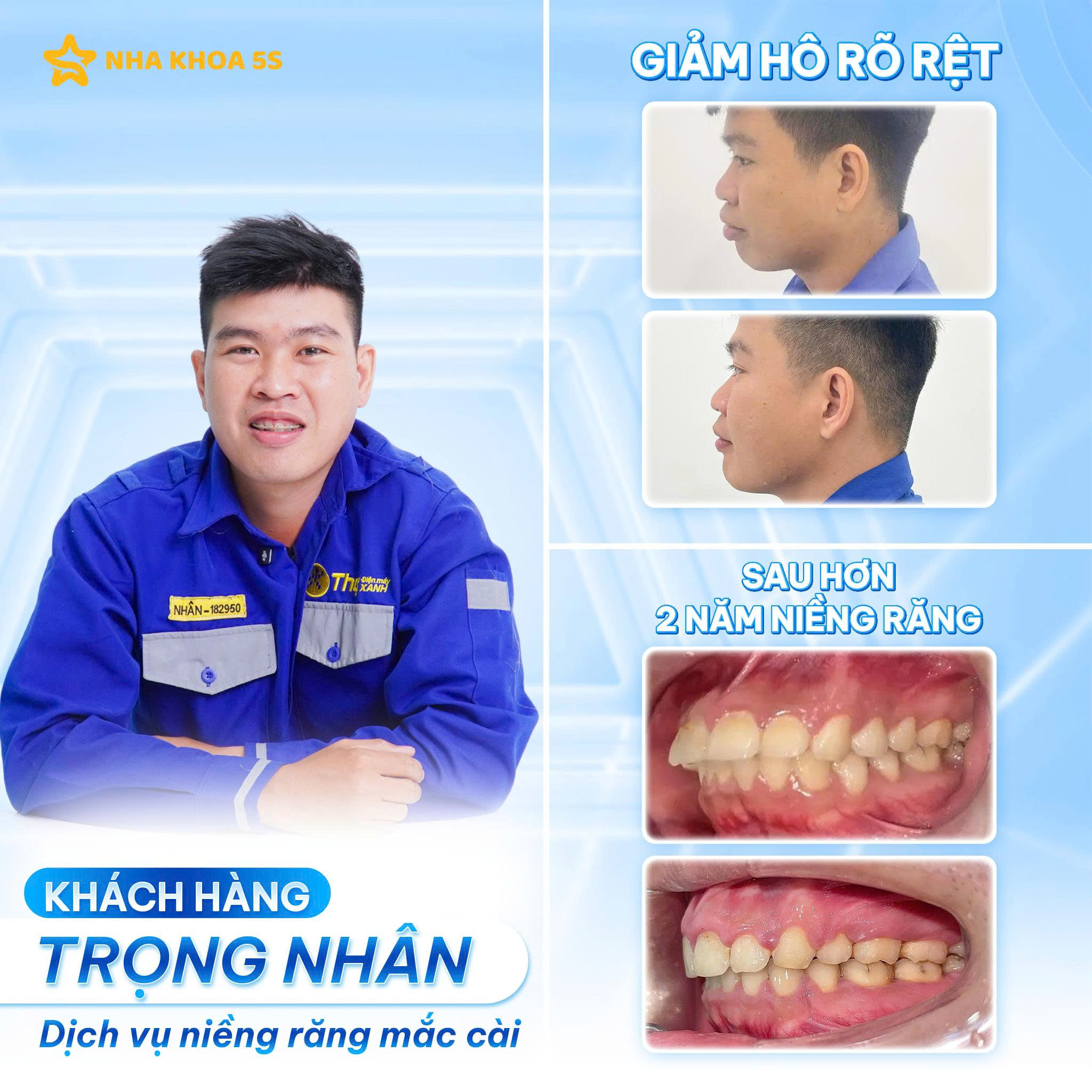 Nha Khoa 5S Facebook ad: HƠN 2 NĂM NIỀNG RĂNG - GIẢM HÔ…
