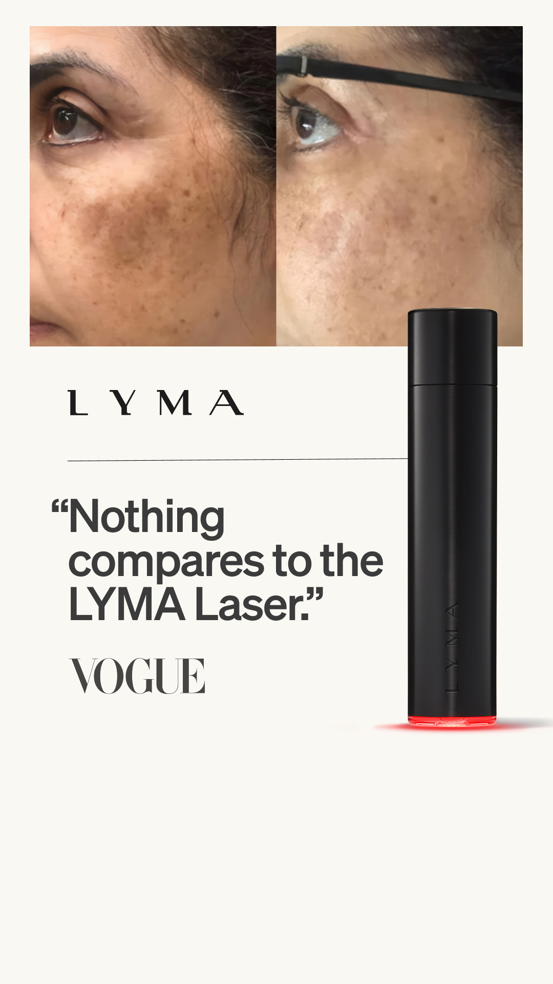 LYMA Facebook ad