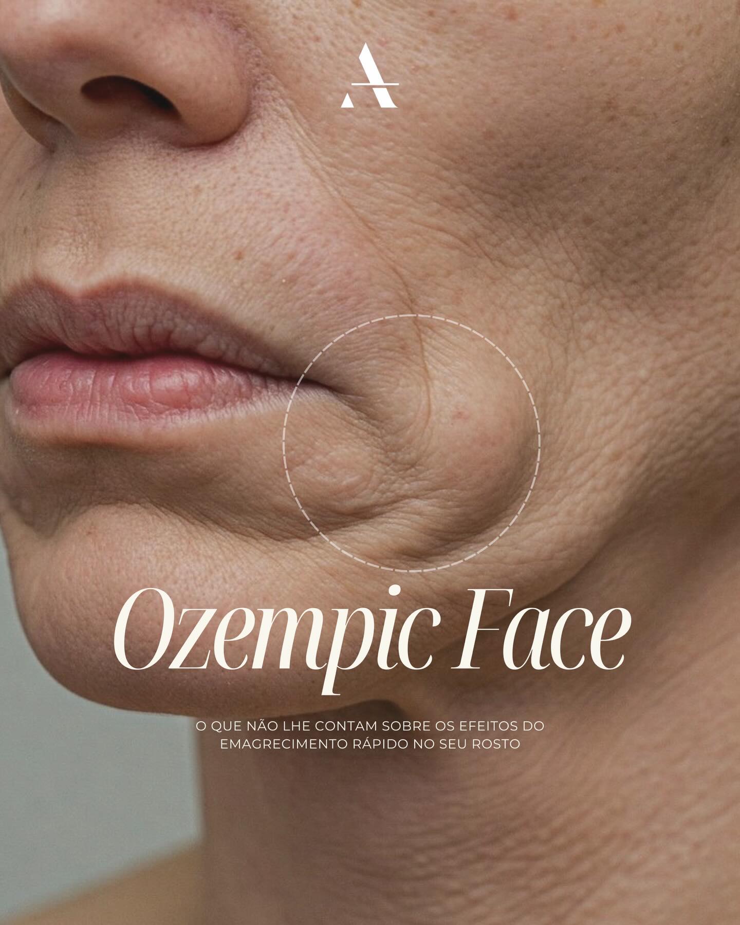 Aesthetic & Dermatology Center Facebook ad