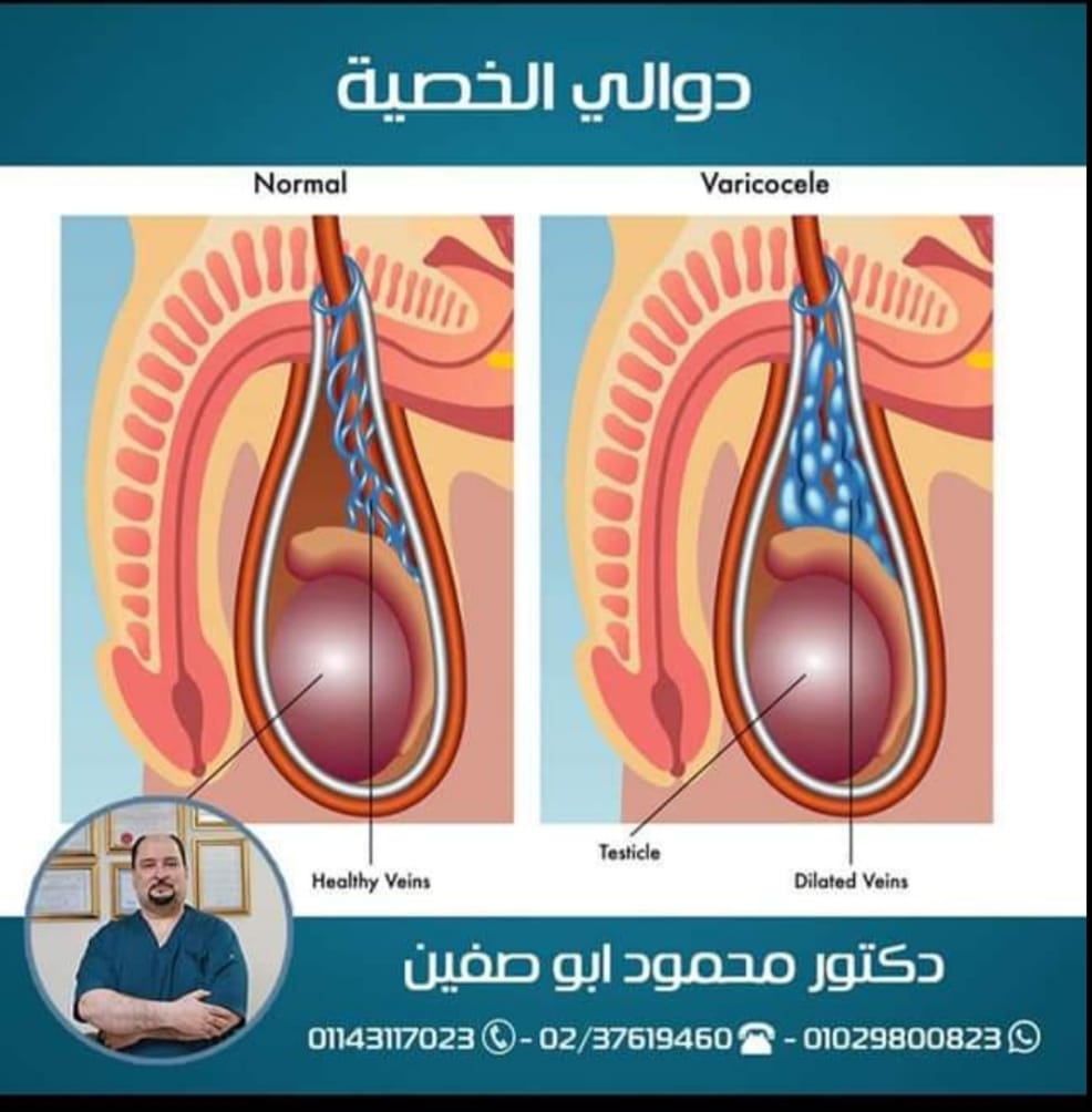 Dr.Mahmoud Abo-Saffain د.محمود أبوصفين Facebook ad: مثال لحالتين.من اللي ربنا اكرمهم علي أيدينا.