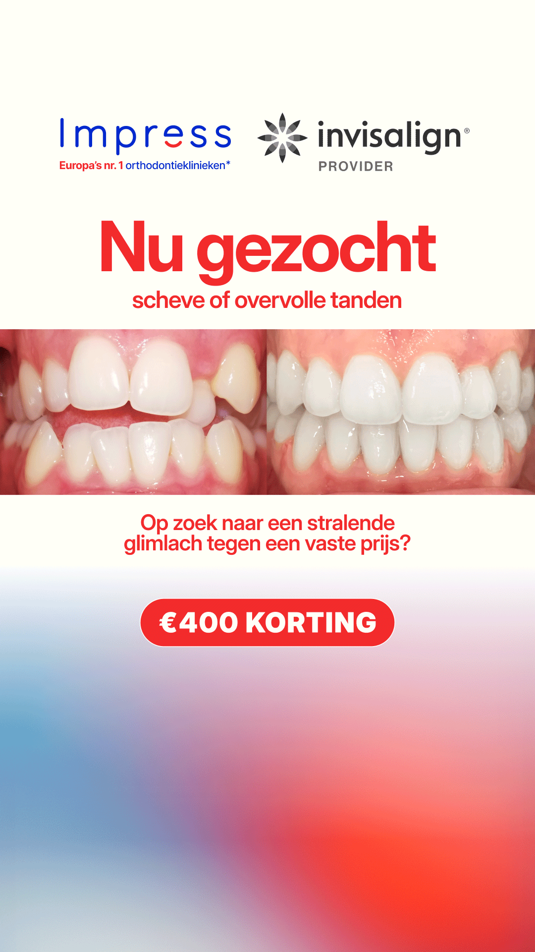 Impress Nederland Aligners Facebook ad