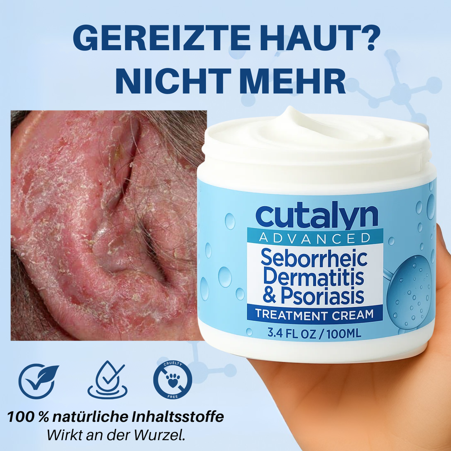 Cutalyn-de Facebook ad from Dec 23, 2025