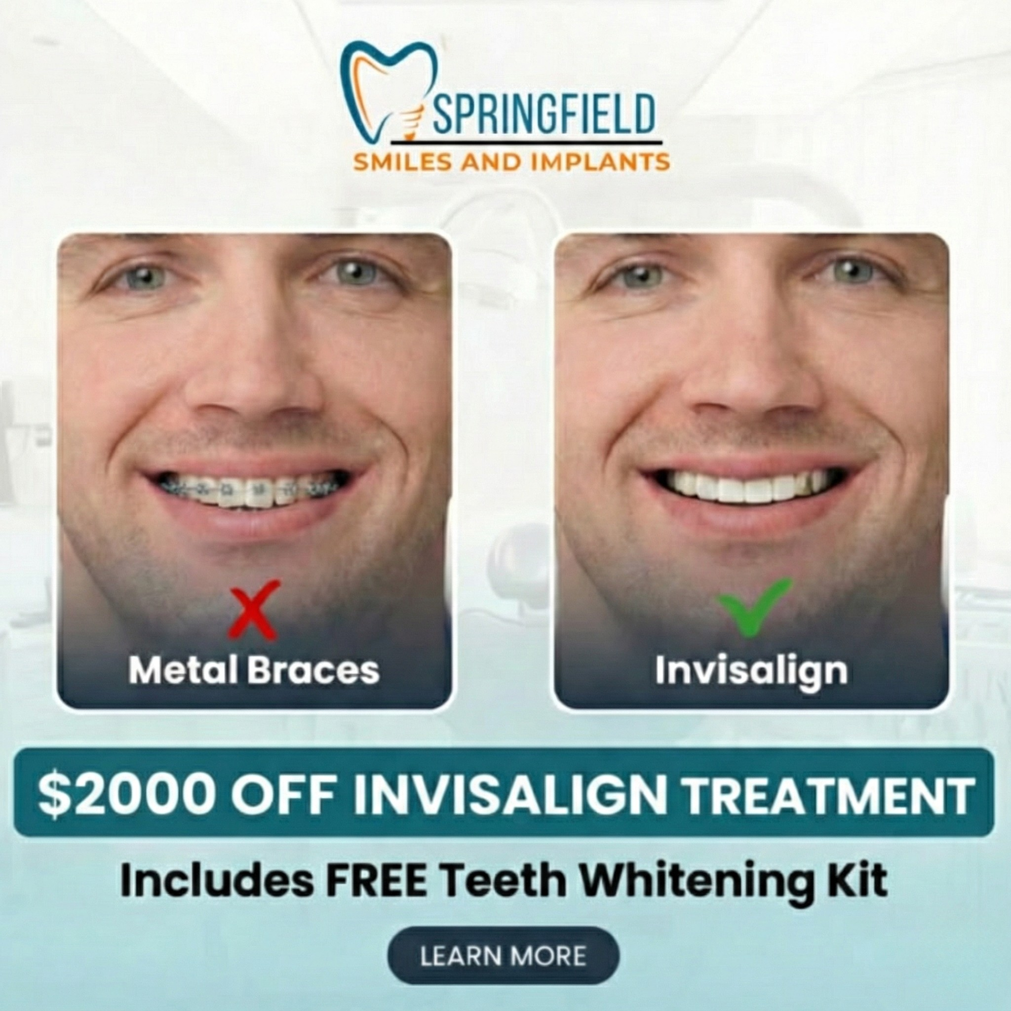Springfield Smiles & Implants Facebook ad: Get $2,000 OFF Invisalign New Year Special, Limited Time…