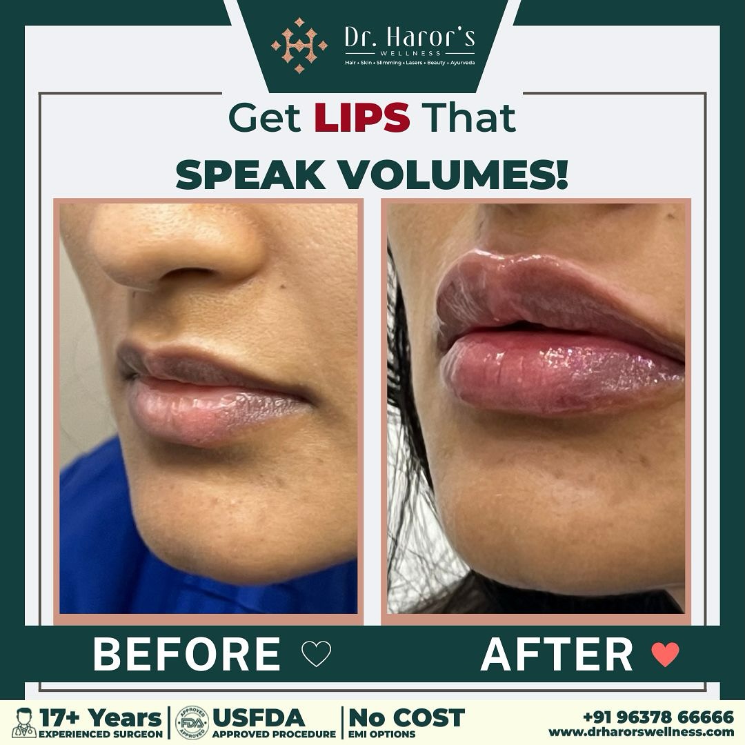 dr.harorswellness Facebook ad: Plump, Perfect, and Naturally Beautiful!
