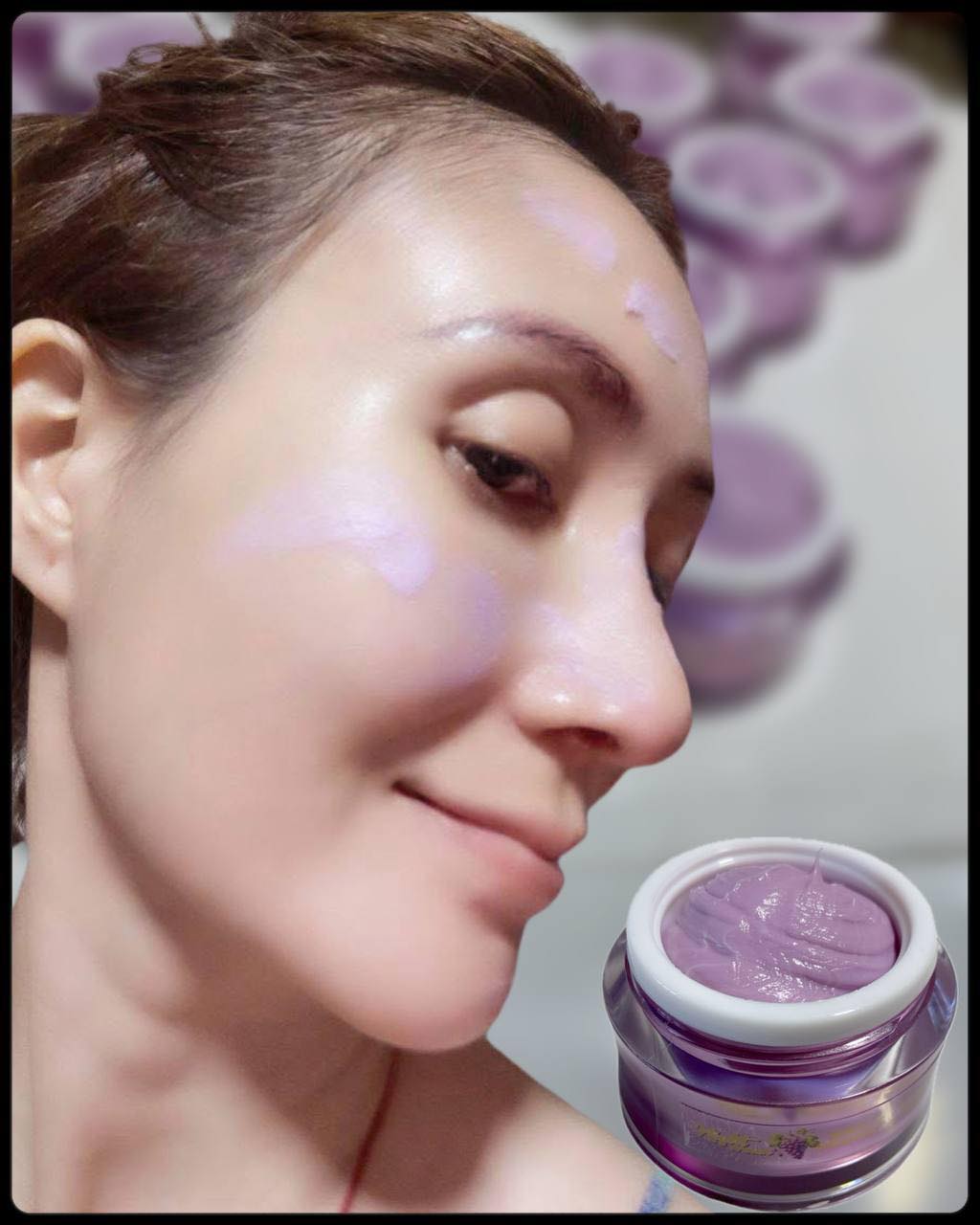New Queen Facebook ad: មុខជាំ អាចម៍រុយ មុនតូច ធំ កប់ ក្នុងសាច់ មុនផ្កាស្បូន…