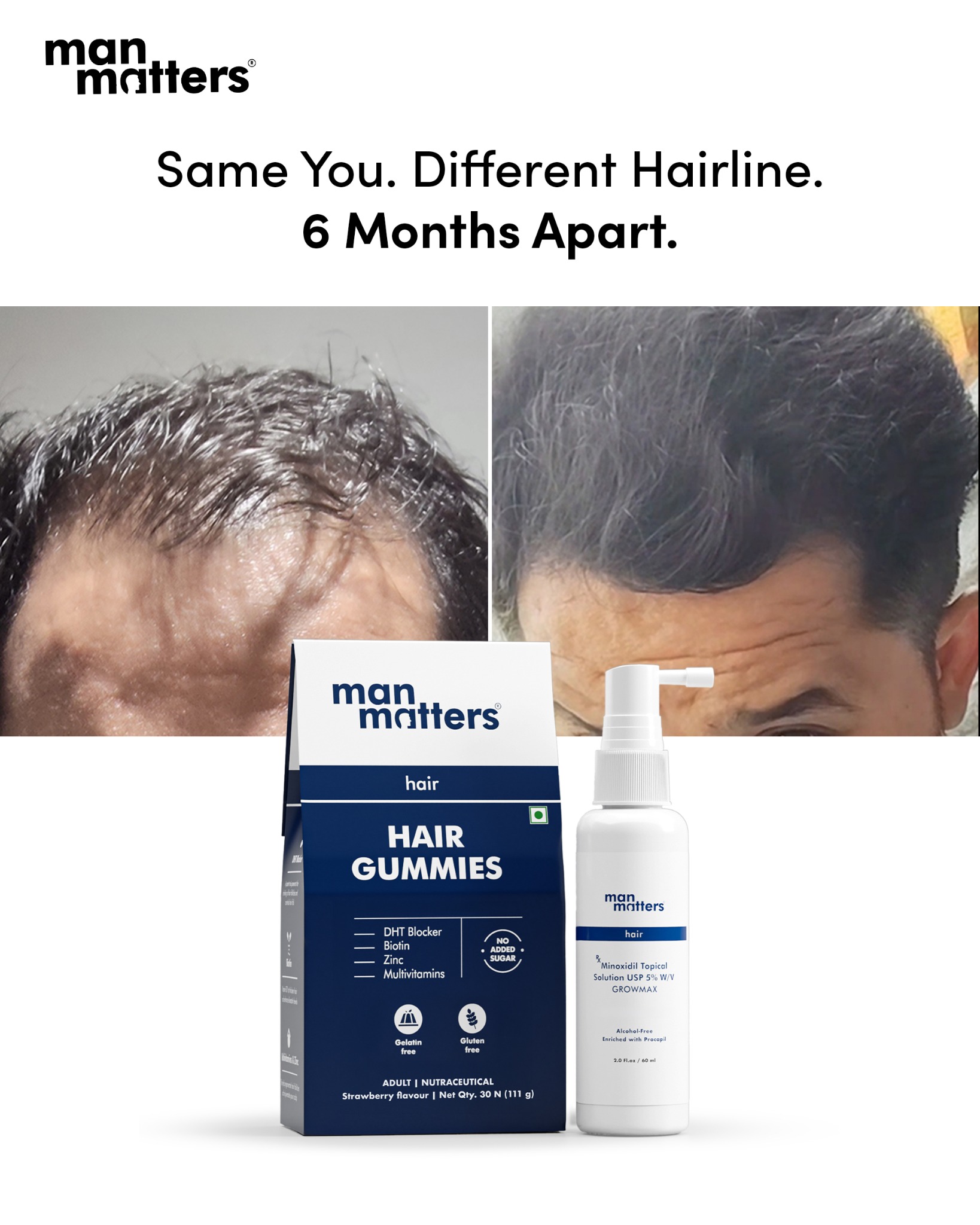 manmattershairwarriors Facebook ad
