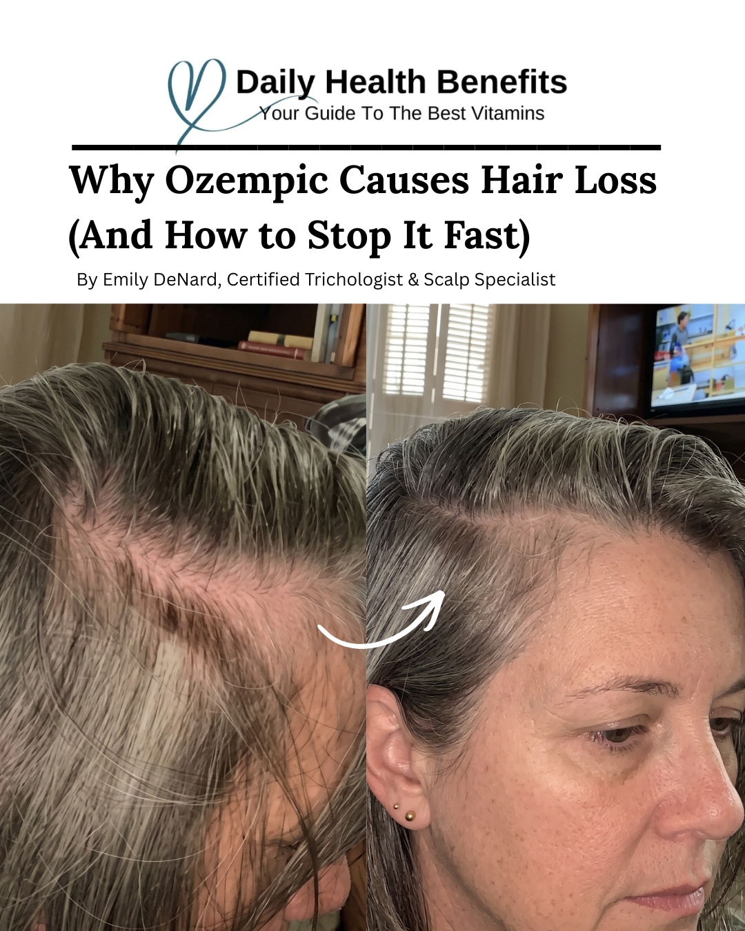 Certified Trichologist & Scalp Specialist Emily DeNard, Emunah Beauty Facebook ad: Scalp Specialists Honest Review Of 2026 Top Hair Growth…
