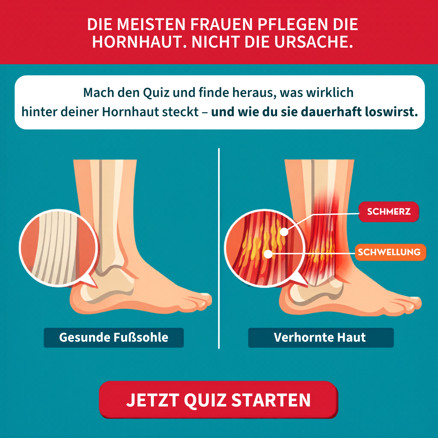 Fußpflege Ratgeber Facebook ad: Mach das kostenlose Quiz und erhalte deinen persönlichen…