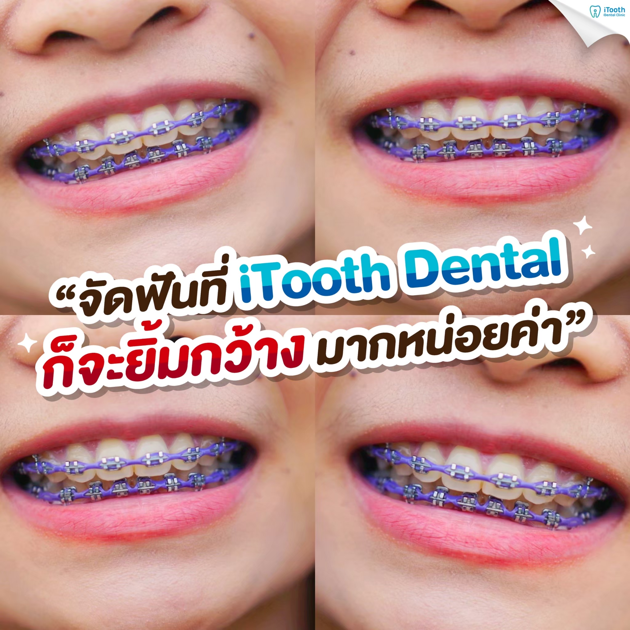 Itooth dental clinic ทันตกรรม ครบวงจร Facebook ad