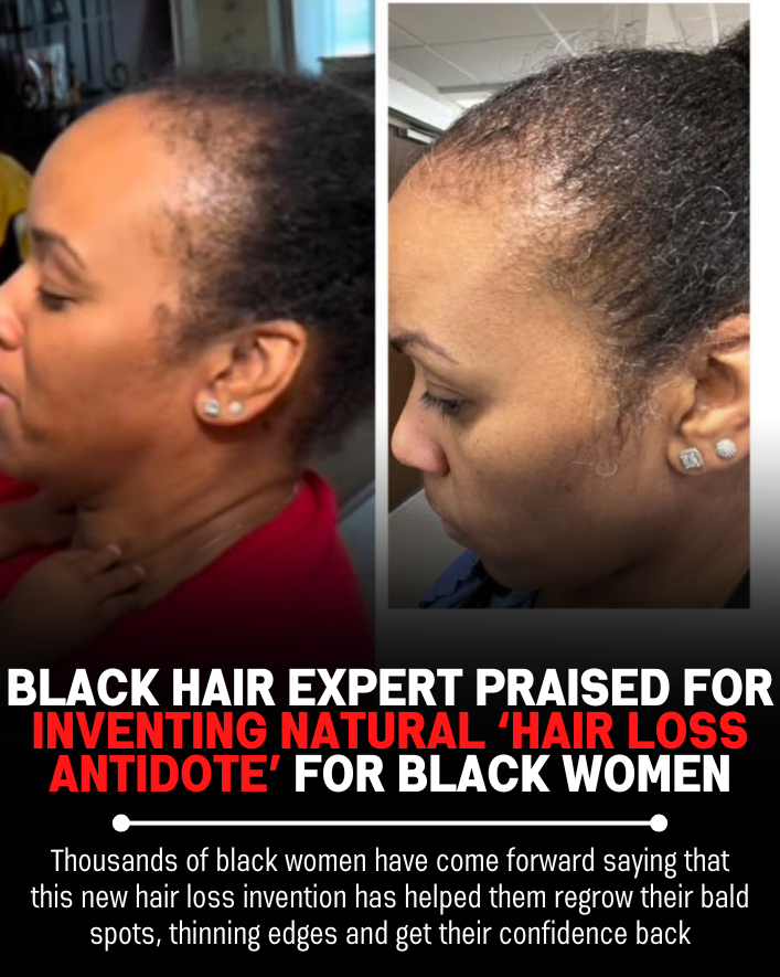 Black Hair Growth Remedy Facebook ad