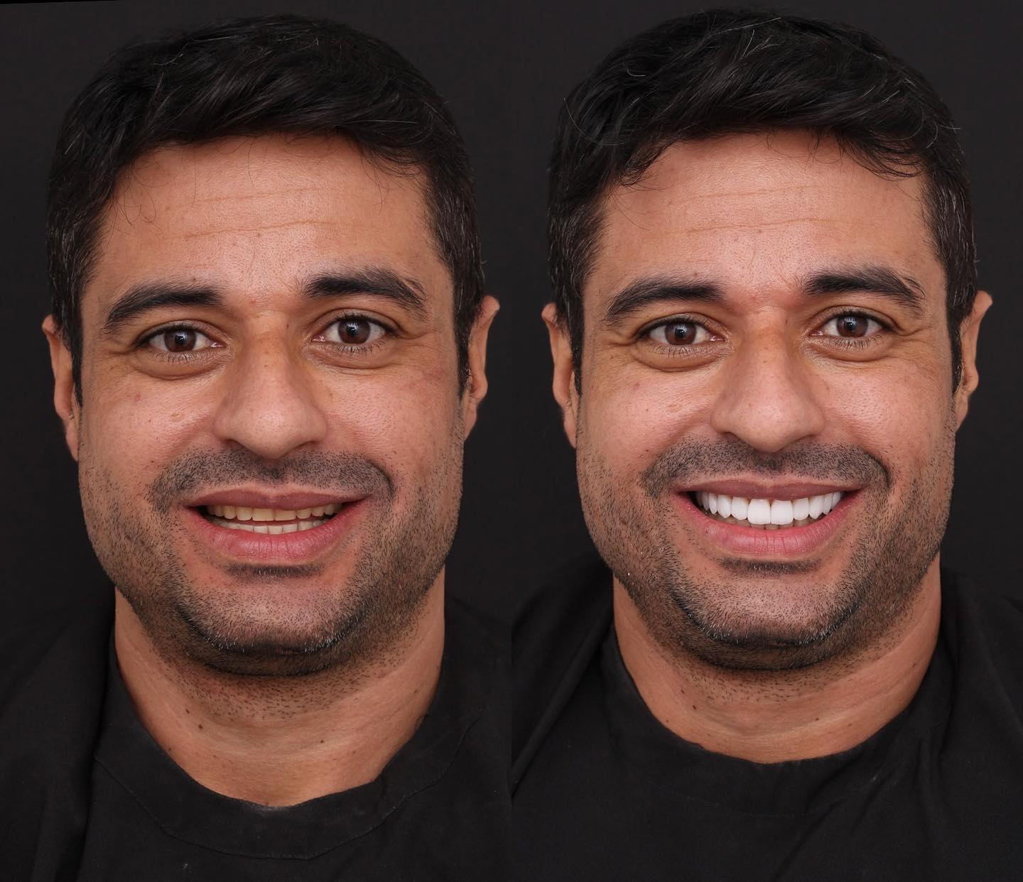 Rildo Lasmar Odontologia e Estética Facebook ad
