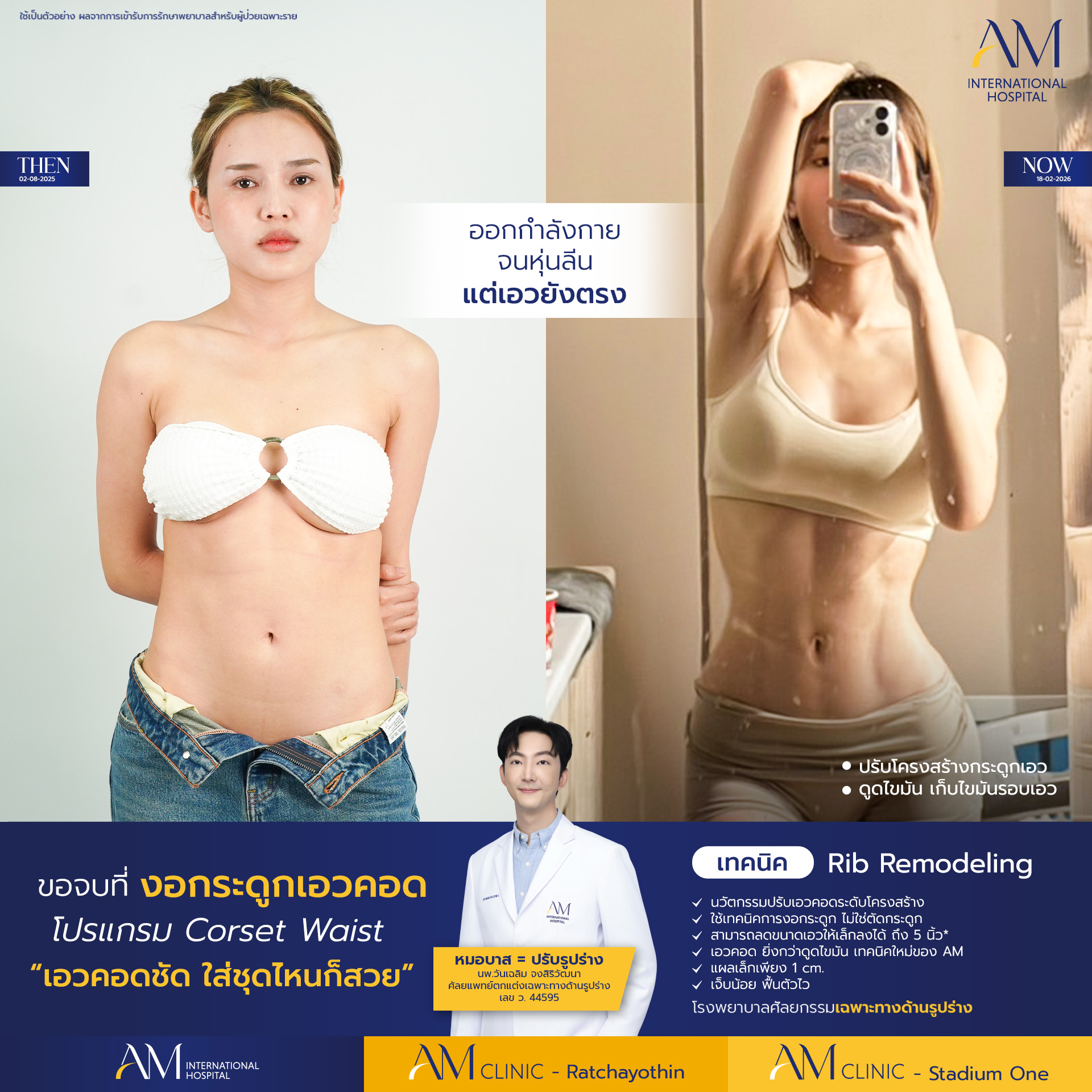 AM Body Surgery โรงพยาบาลเฉพาะทาง ศัลยกรรมตกแต่งหนังหน้าท้อง เสริมหน้าอก Facebook ad