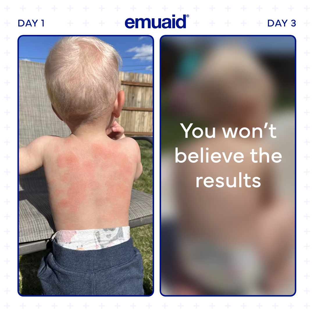 Emuaid Facebook ad