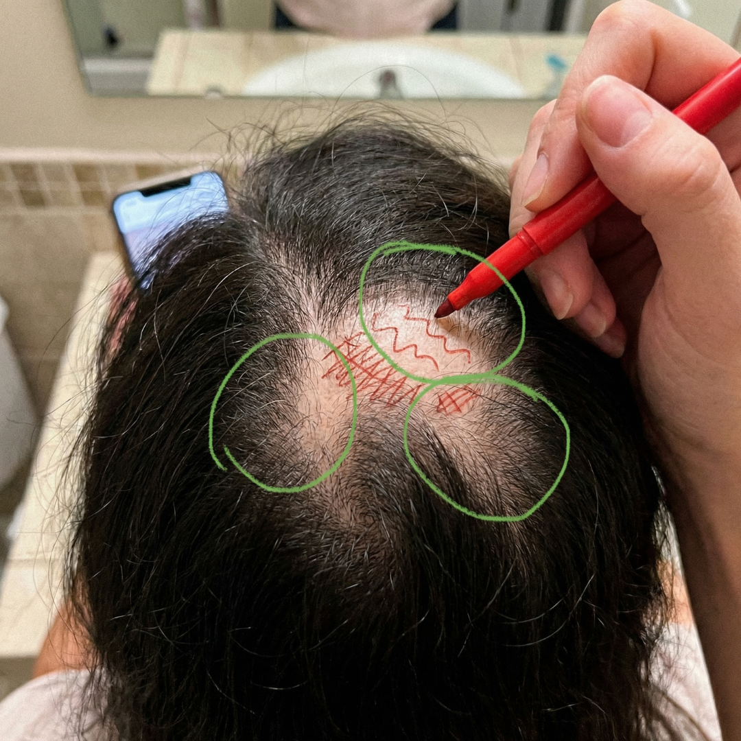 Sara Williams Facebook ad: I wish I'd know this one thing about hair loss