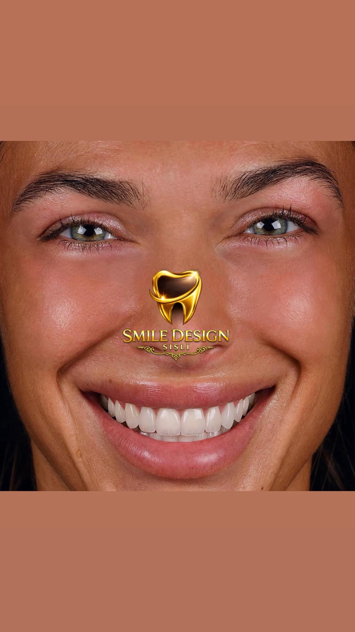 Smile Design Şişli  Facebook ad