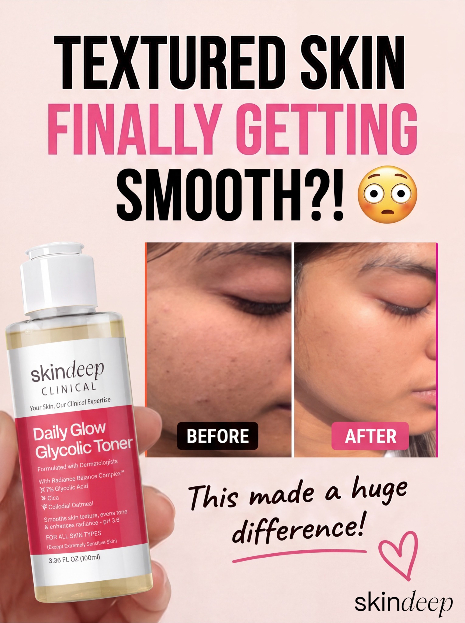 Skin Deep Facebook ad