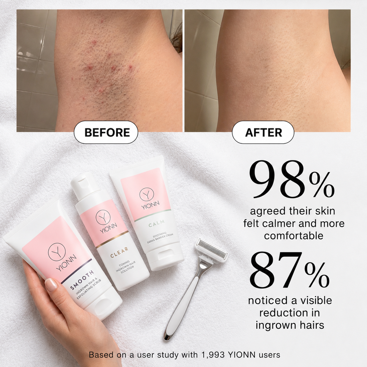 YIONN Facebook ad: What if it isn't your sensitive skin?