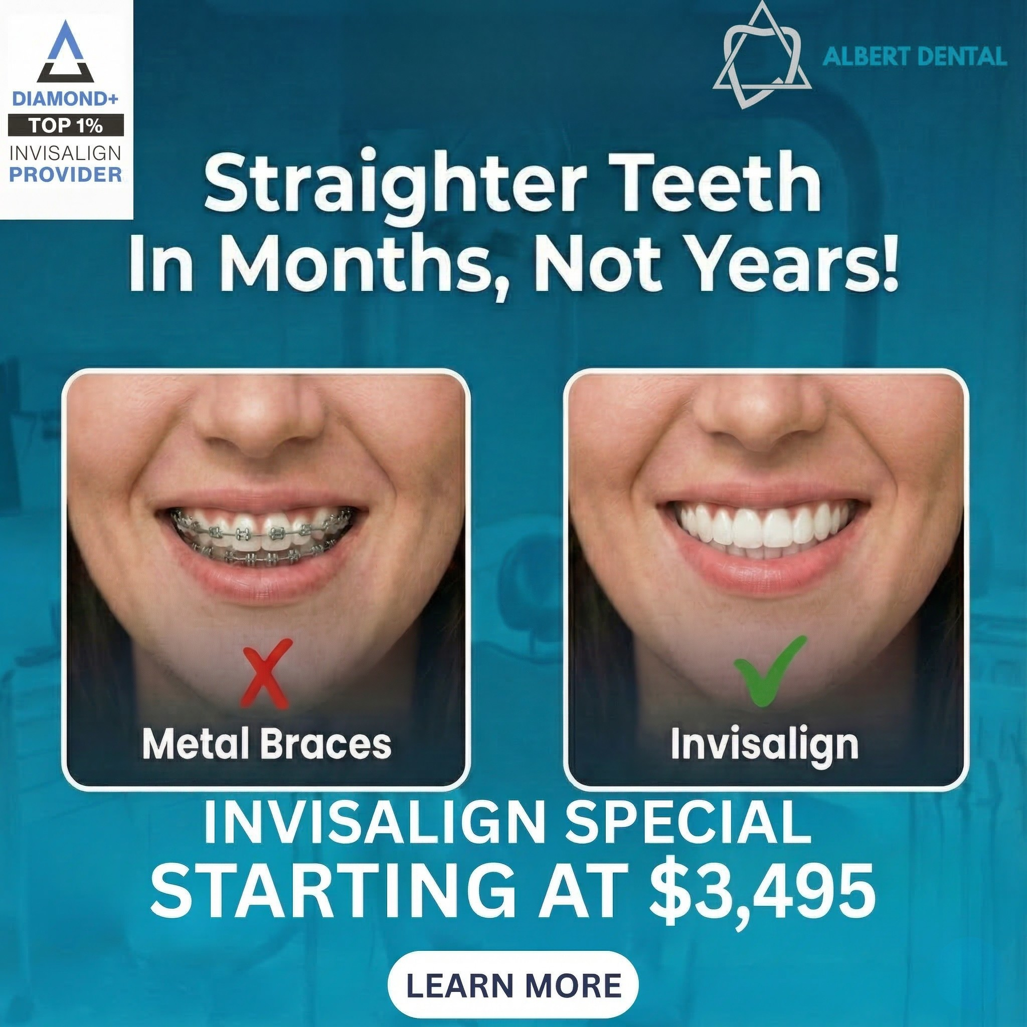 Albert Dental Facebook ad: Hey, Olathe & Overland Park! Invisalign starting At Just…