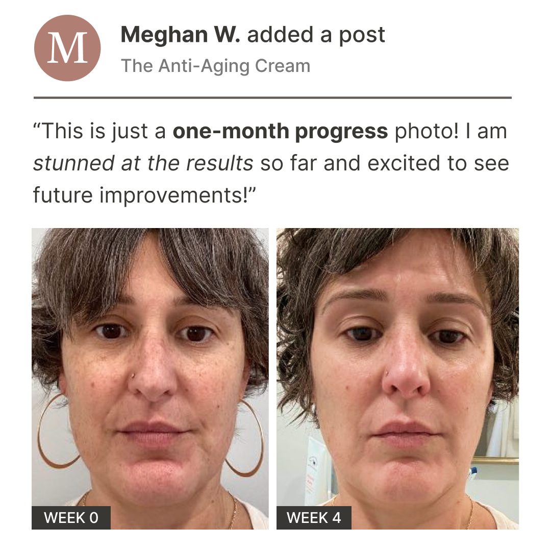 Musely FaceRx Facebook ad
