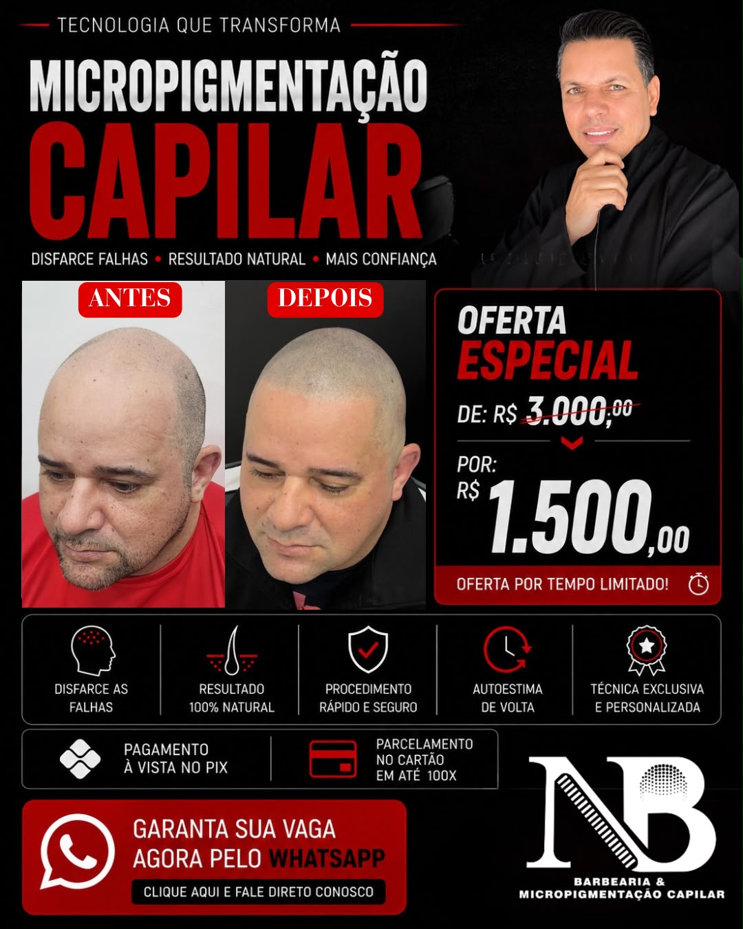 Espaço NB - Micropigmentação Capilar & Barbearia Facebook ad: Micropigmentação capilar por R$ 1.500