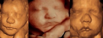 Peek A Baby Fresno Facebook ad: Ultrasound Center | Northern California - Peek A Baby