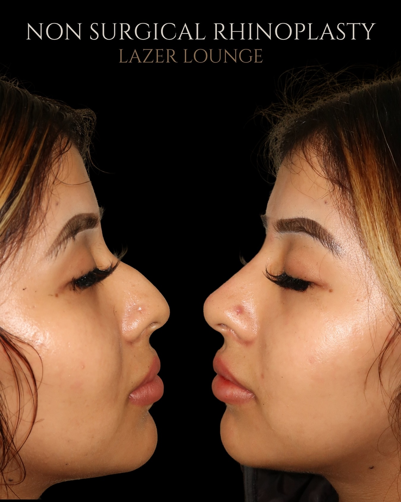 Lazer Lounge Facebook ad: No surgery, no scars, just our Non Surgical…