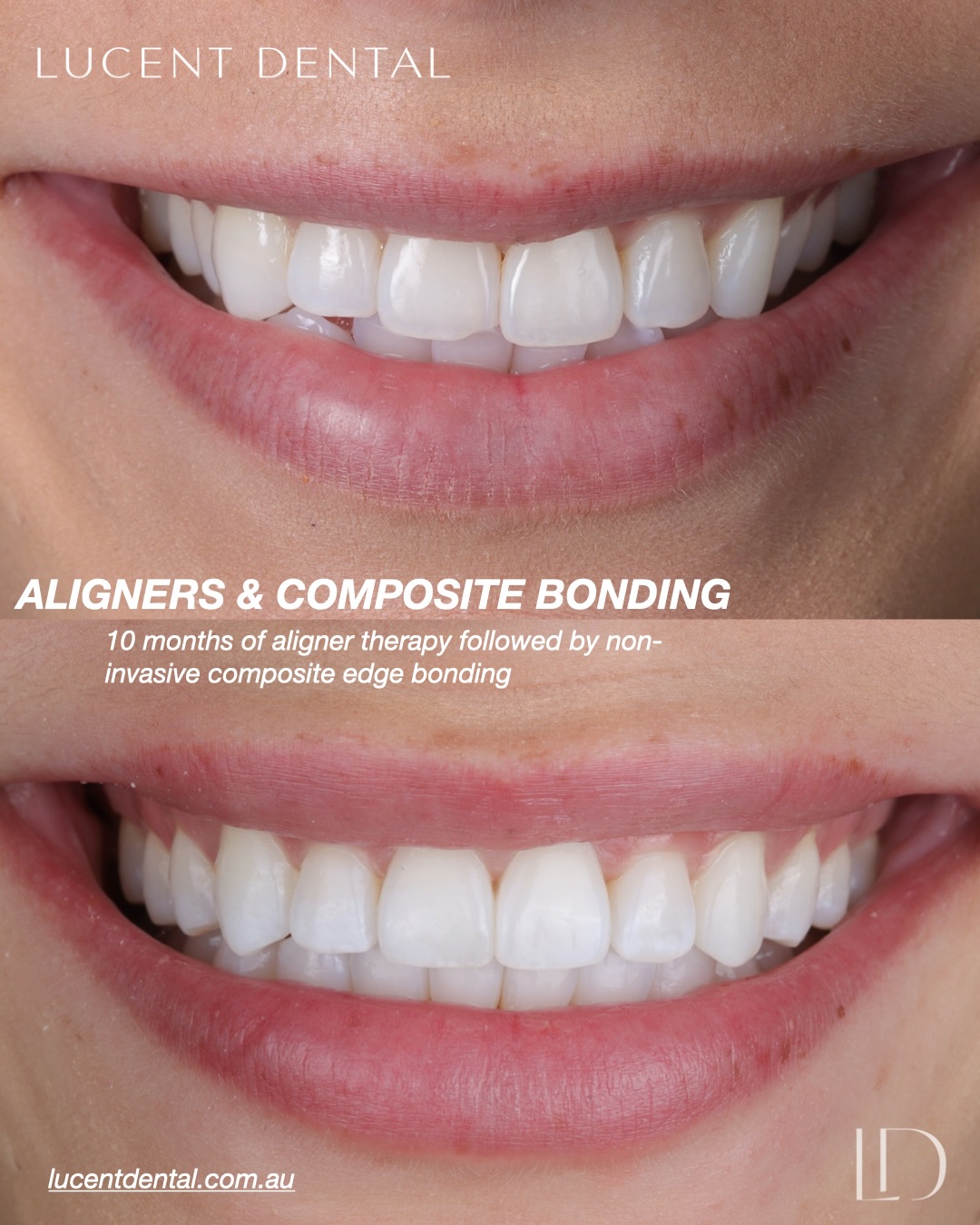 Lucent Dental Facebook ad