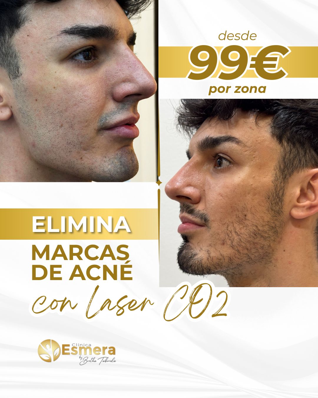 Clínica Esmera Facebook ad