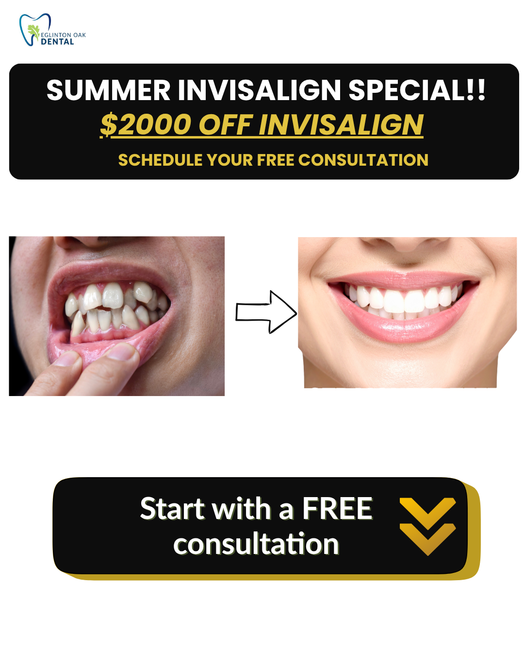 Eglinton Oak Dental Facebook ad: $2000 OFF Summer Invisalign Special