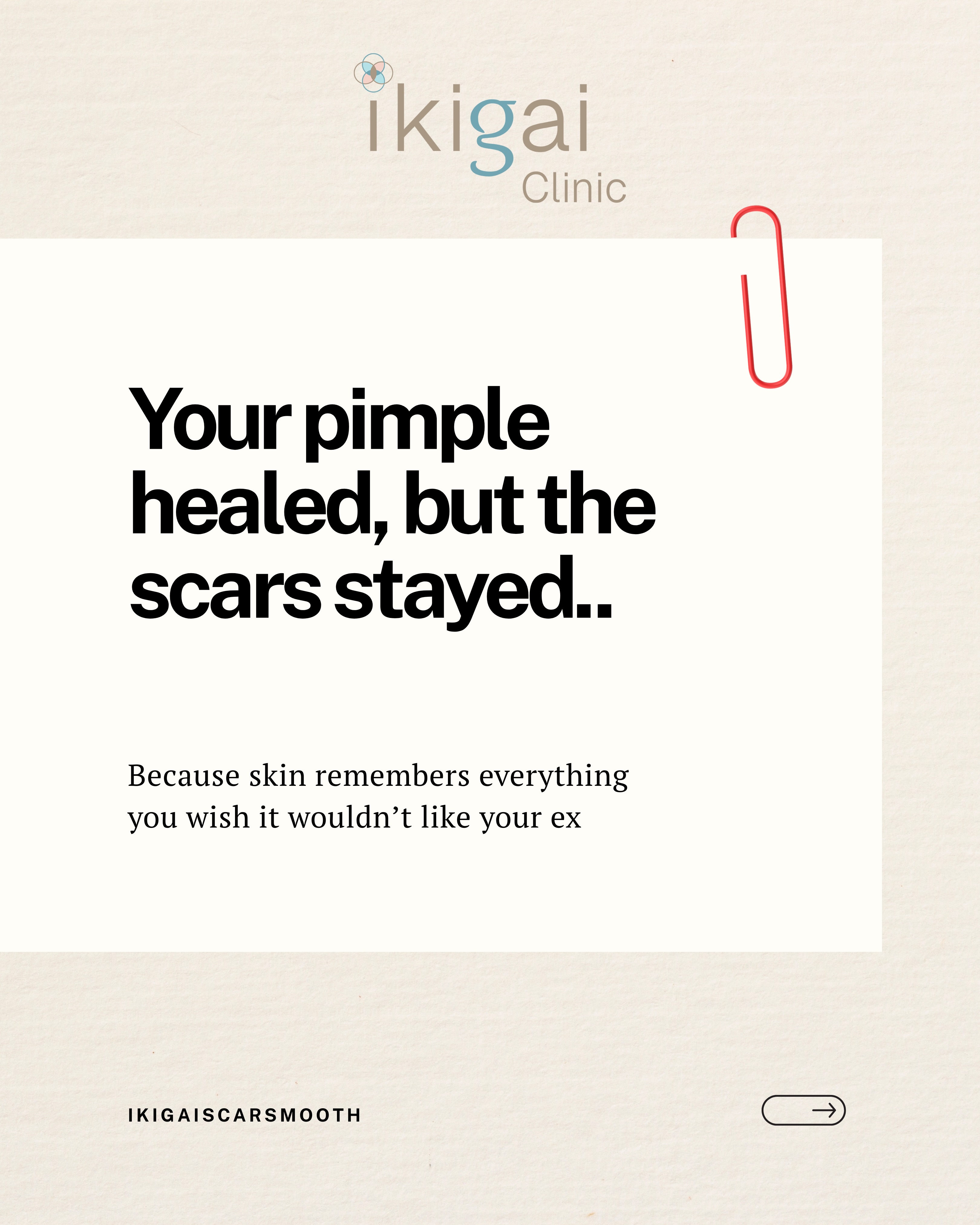 Ikigai Clinic Facebook ad: Feeling insecure of acne scars that never seem…
