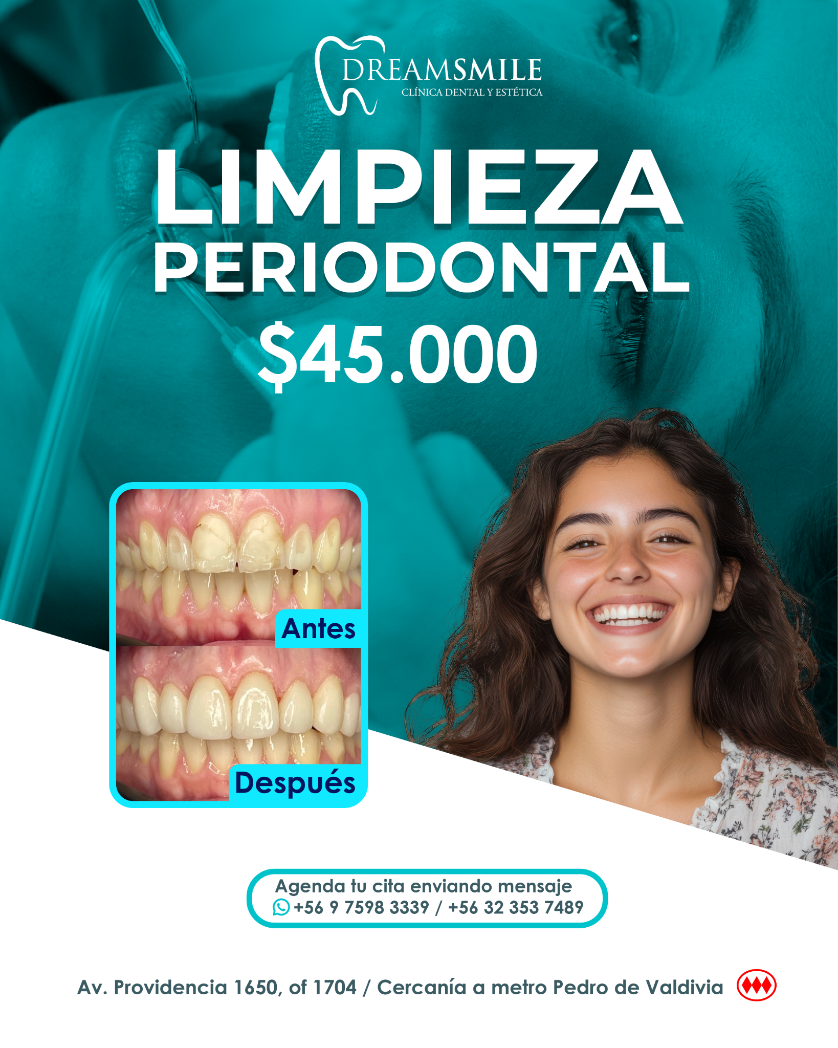 Clínica Dental Dream Smile Odontología e Innovación Facebook ad: Sonrisa sana y más blanca $45.000