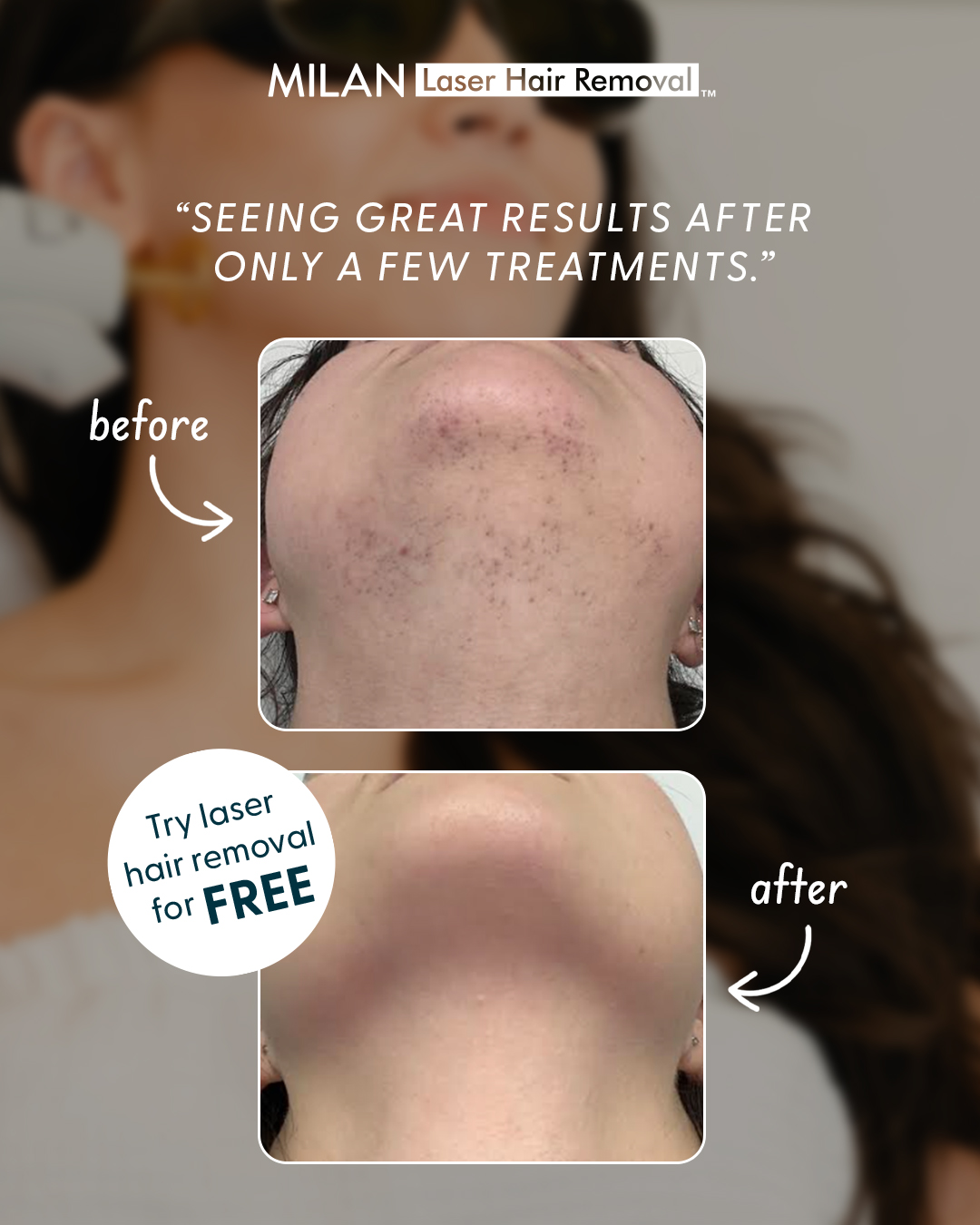 Milan Laser Hair Removal Facebook ad