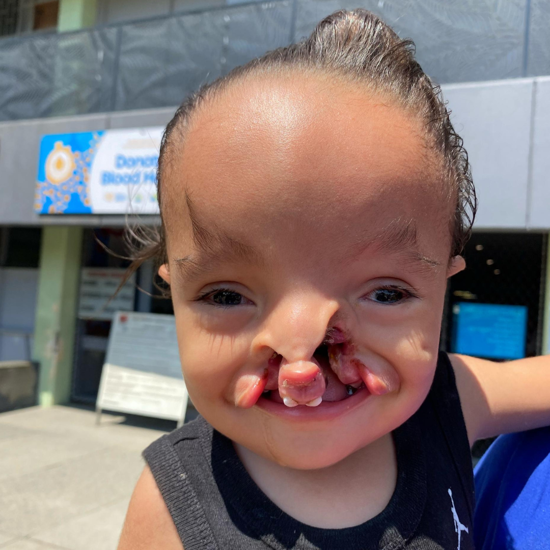 Children First Foundation Facebook ad: Help him now