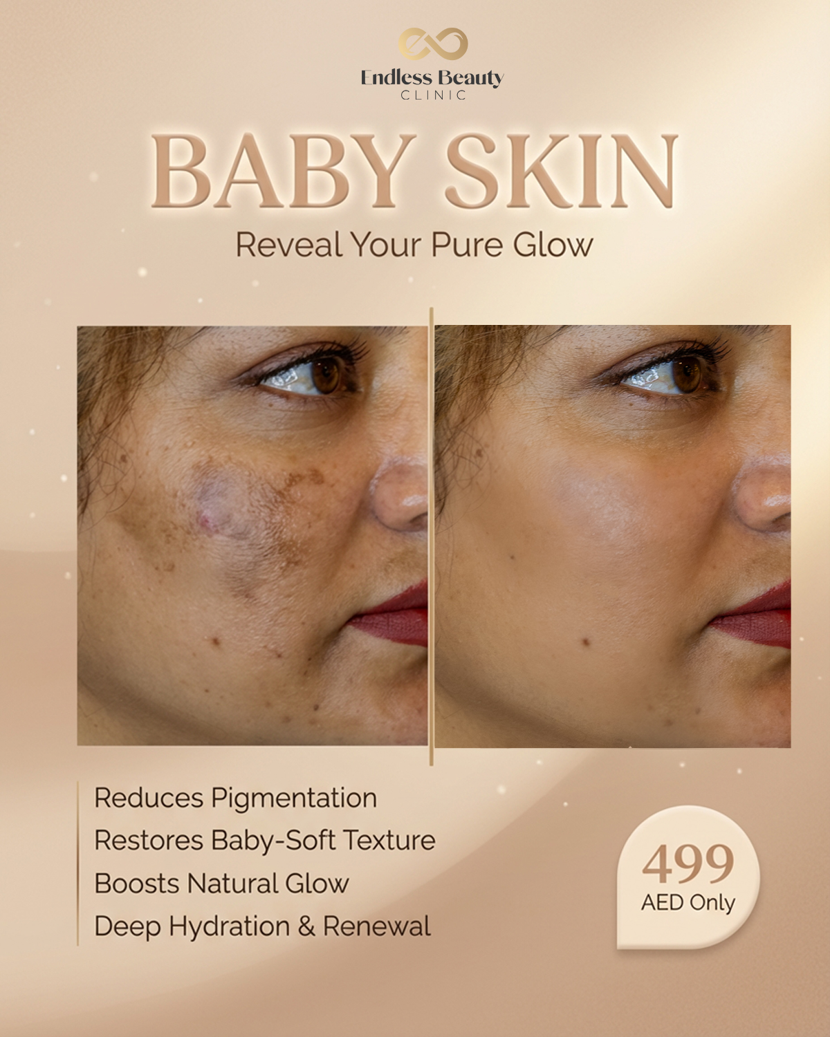Endless Beauty Clinic Facebook ad