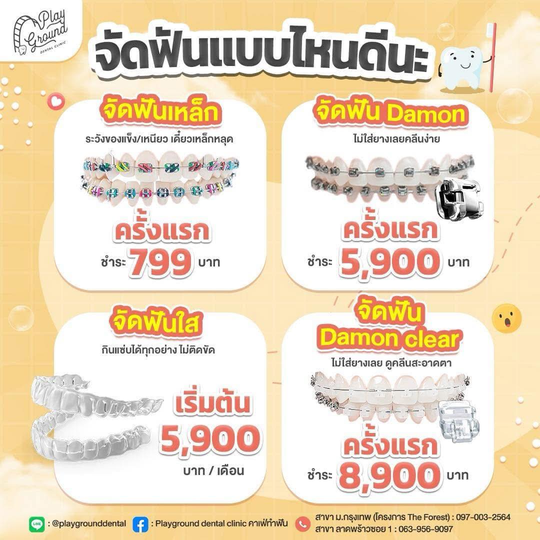 Playground Dental Clinic คาเฟ่ทำฟัน Facebook ad: จัดฟันแบบไหนดี มีมาให้เลือก 4 แบบ